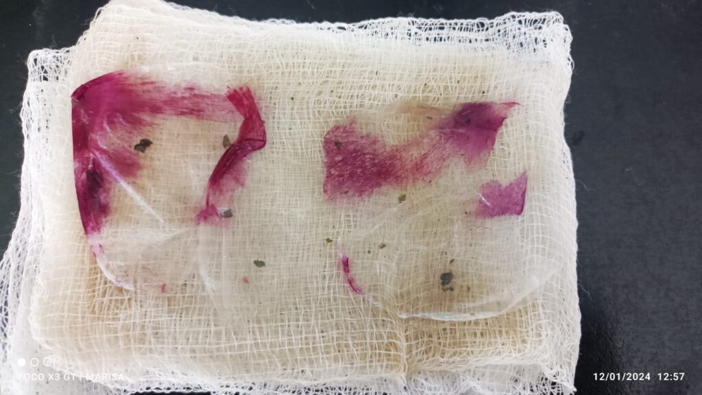 Fig 12: Realizamos el mismo procedimiento pero cambiando las capas de cebolla por cebolla morada