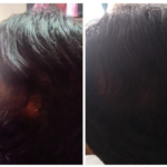 . El paciente comenta que notó crecimiento en donde ya no tenía cabello, así como humectación y brillo.